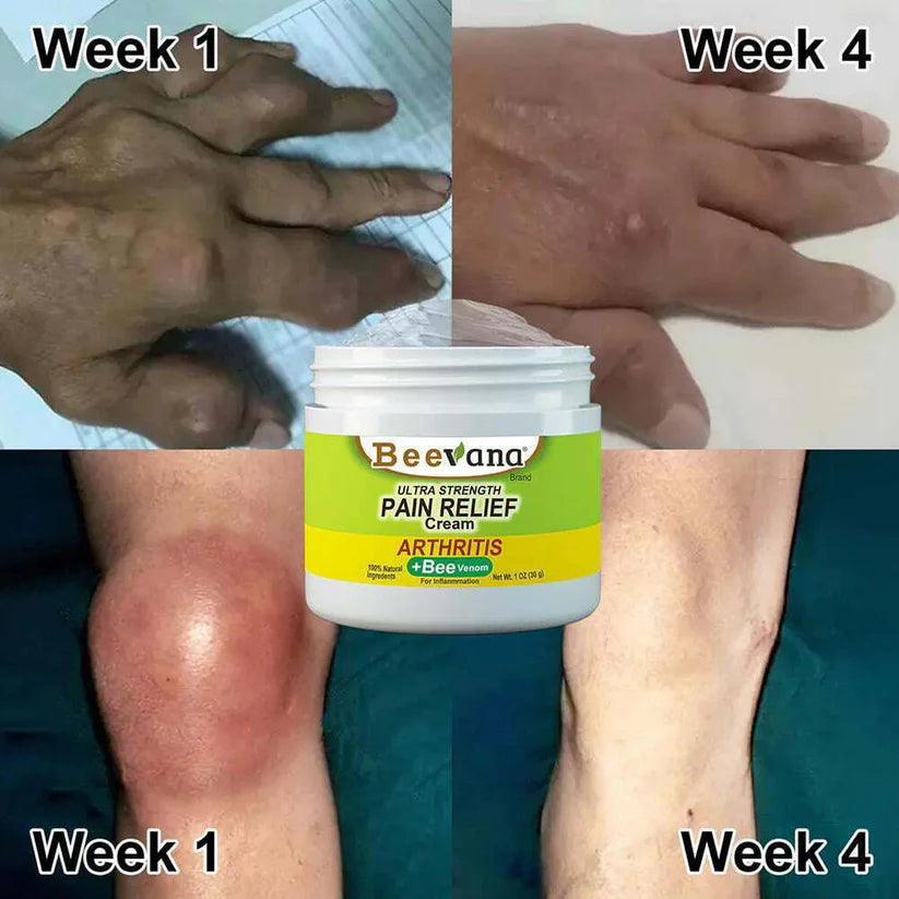𝐎𝐑𝐈𝐆𝐈𝐍𝐀𝐋™ 𝐁𝐞𝐞 𝐕𝐞𝐧𝐨𝐦 𝐉𝐨𝐢𝐧𝐭 𝐚𝐧𝐝 𝐁𝐨𝐧𝐞 𝐓𝐡𝐞𝐫𝐚𝐩𝐲 𝐂𝐫𝐞𝐚𝐦 🐝(🔥𝐁𝐔𝐘 𝟏 𝐆𝐄𝐓 𝟐 𝐅𝐑𝐄𝐄🔥) - Image 11