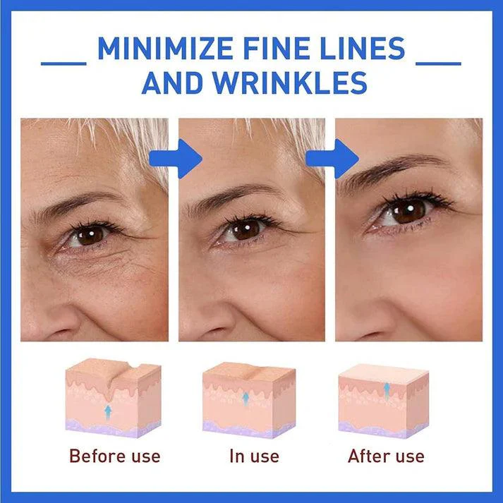 Botox Anti-Aging Serum (Buy 1 Get 1 Free) - Image 7