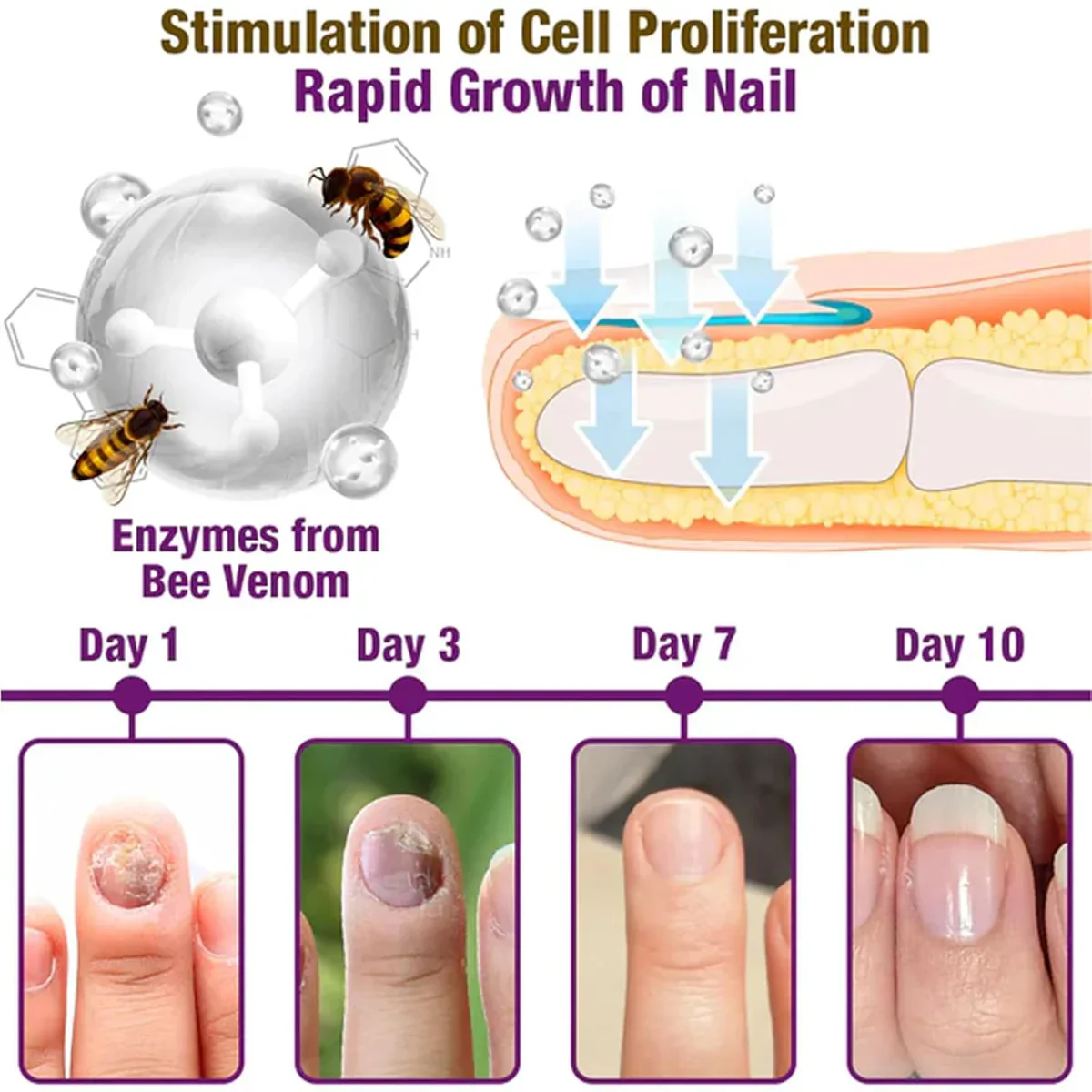 Bee Venom Nail Treatment Serum [Repair Your Nail] Buy 1 Get 1 Free 😍 - Image 5