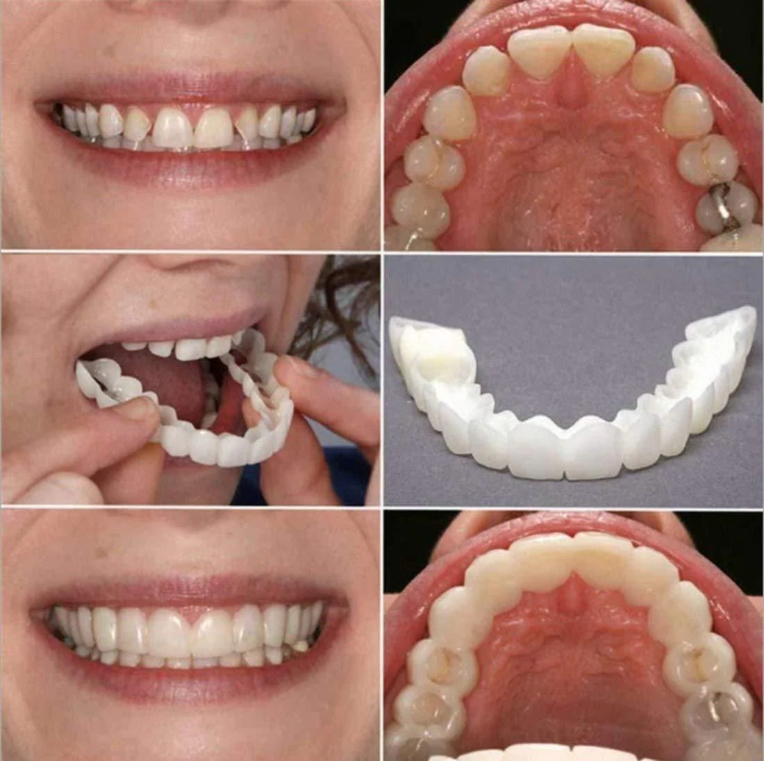 Instant and Confident on Smile Fit Flex Cosmetic Teeth Denture Teeth - Image 6