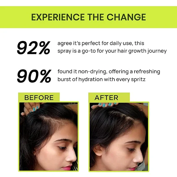 🔥BUY 1 GET 2 FREE🔥-🌿 Rosemary Water Hair Spray for Regrowth 🌿 - Image 2