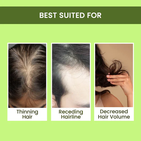 🔥BUY 1 GET 2 FREE🔥-🌿 Rosemary Water Hair Spray for Regrowth 🌿 - Image 4