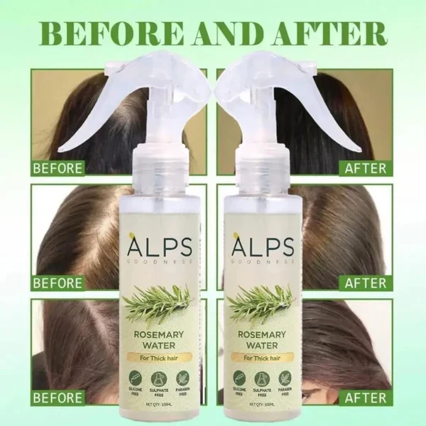🔥BUY 1 GET 2 FREE🔥-🌿 Rosemary Water Hair Spray for Regrowth 🌿 - Image 6