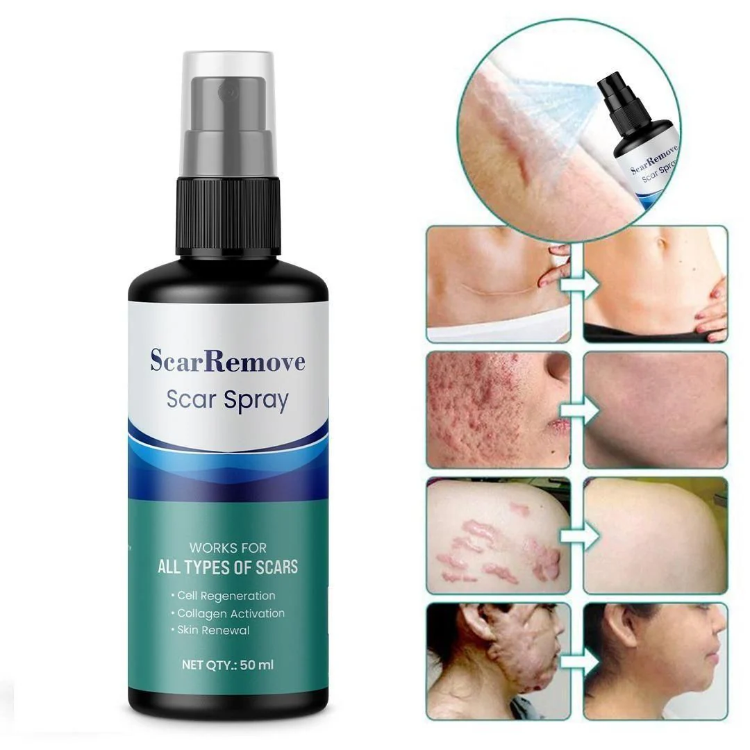 Scar Removal Spray 50ml	Pack Of 2 - Image 5