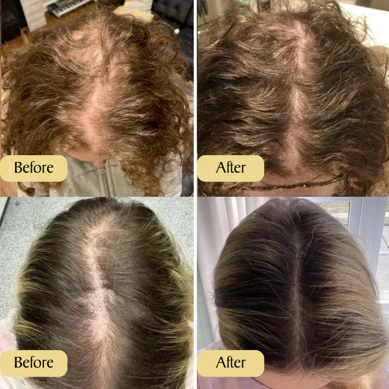 Veganick Natural Hair Growth Oil (Buy 1 Get 1 Free) - Image 8
